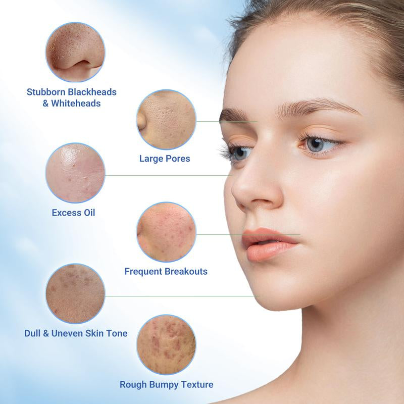 Revitalize Your Skin with Dr. Leo 3-in-1 White Clay Mask – 100g for Deep Pore Detox, Acne Treatment, and Oil Control